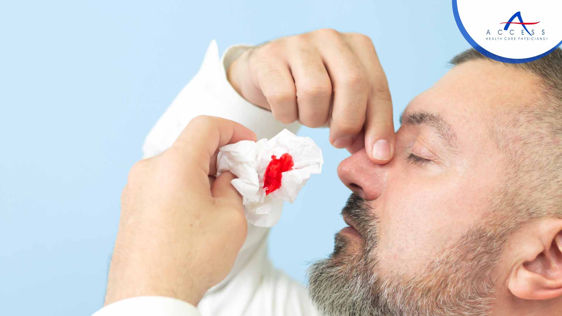 Nosebleeds