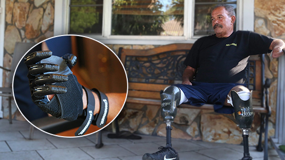 A Gift Of Hands After Loss - A Man Finds Hope In Healing Ones 