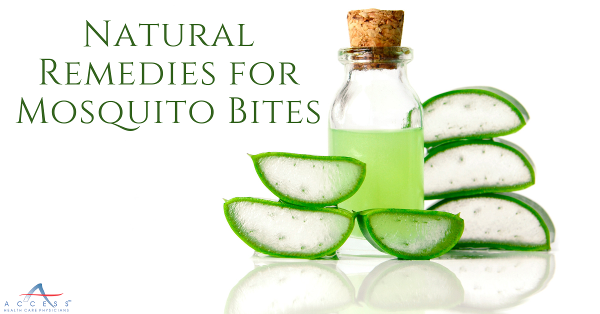 Home Remedies For Mosquito Bites 