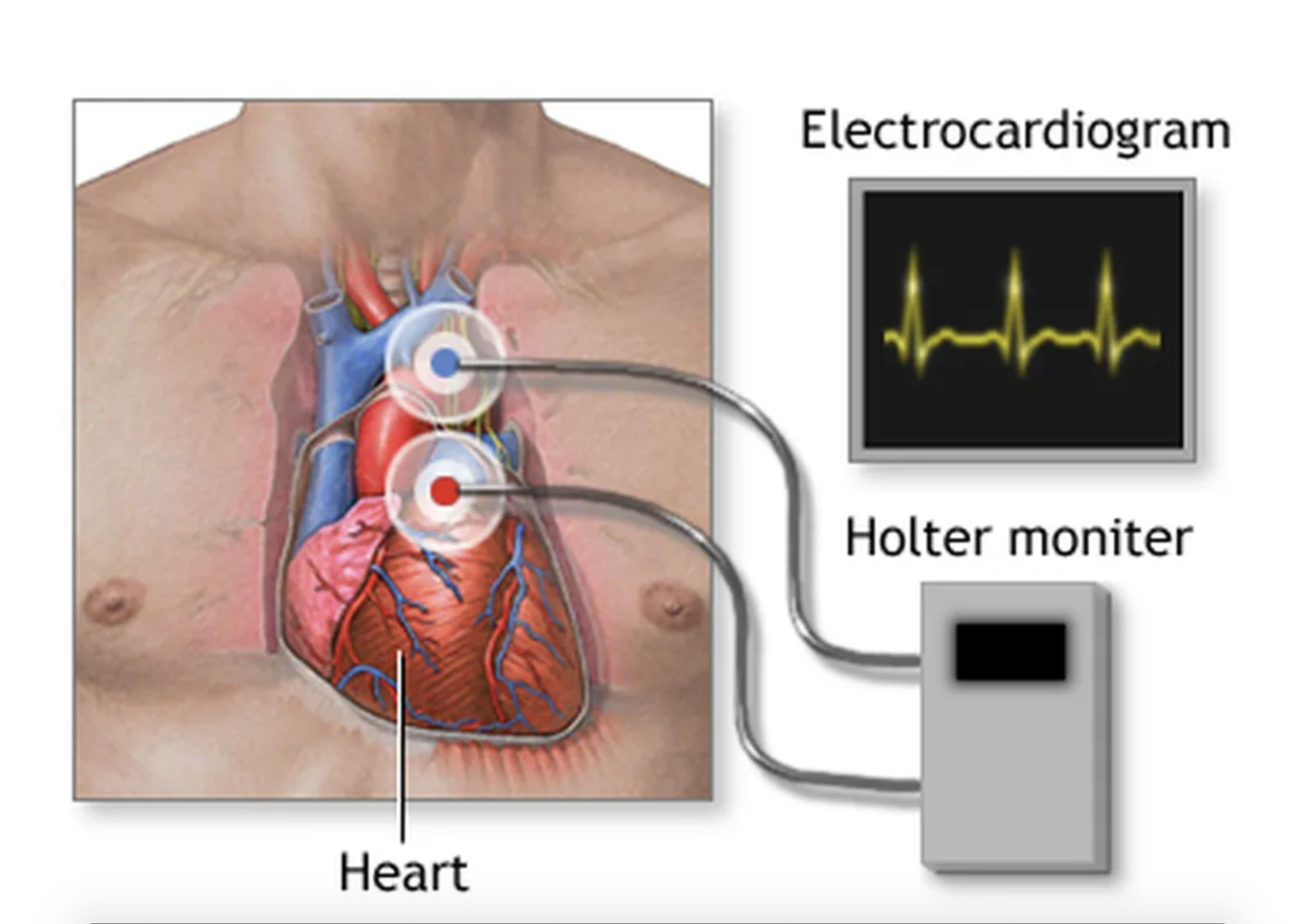 Book an appointment to get the 24-hour Holter test for heart done under the guidance of the best cardiologists